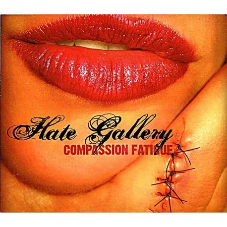 Compassion Fatigue Compassion Fatigue